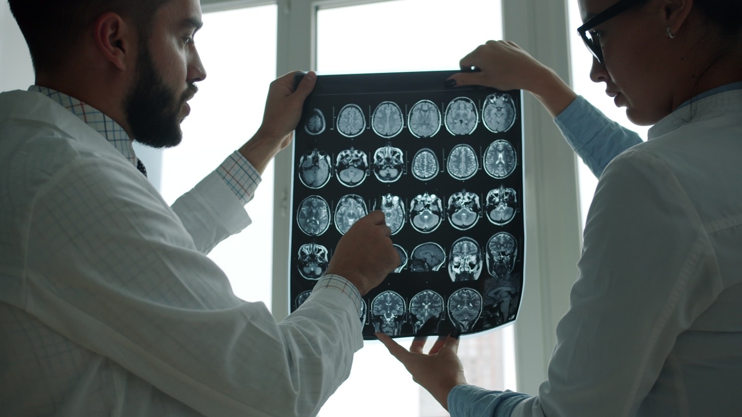 Transforming Lives One Step at a Time: Epilepsy Focus